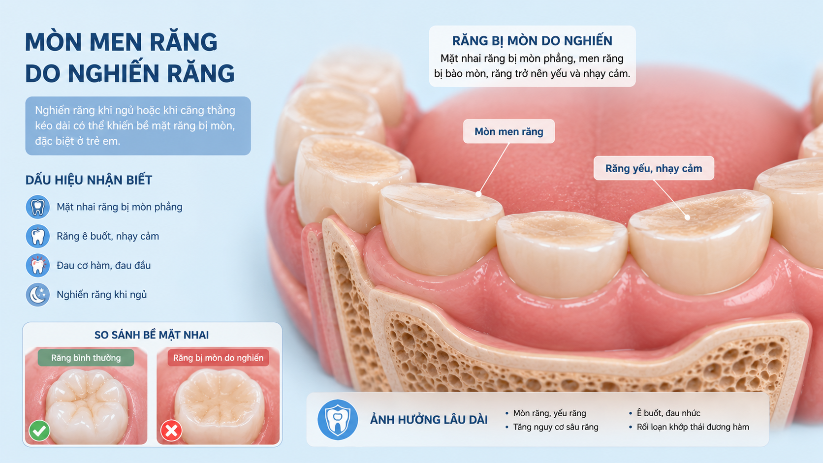 mon-men-rang
