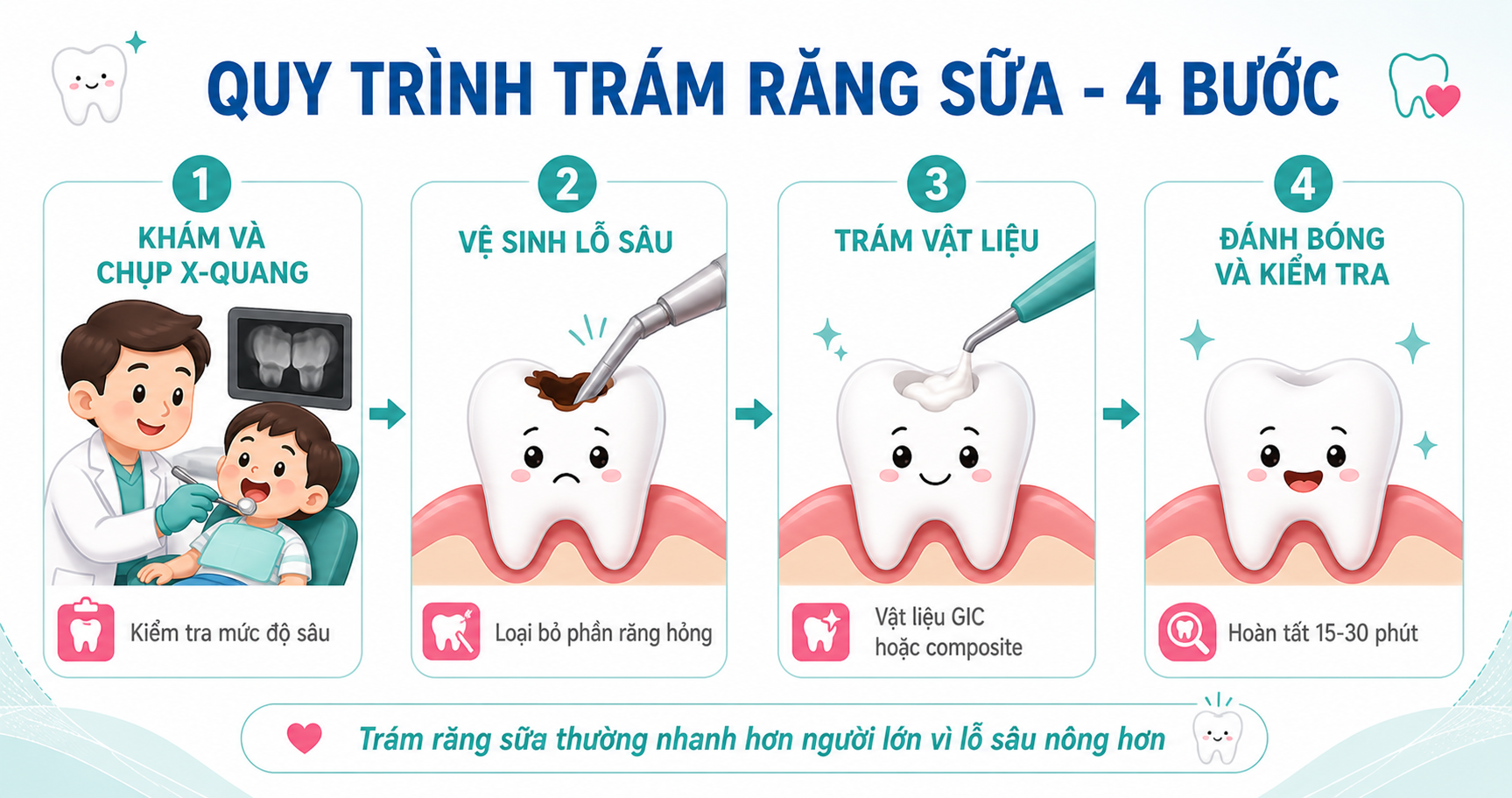 quy-trinh-tram-rang-sua-cho-be-4-buoc